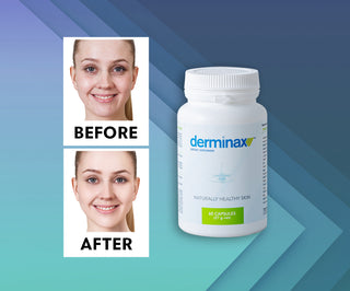 Tablety na akné, pupínky a nedostatky se zinkem, vitamíny C, E a B2 Derminax - 2