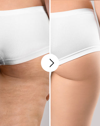 Tablety na celulitidu a zlepšení kondice kůže s přírodními extrakty Cellinea 60 tobolek_3 - 3