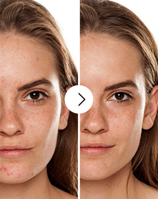 Tablety na akné, pupínky a nedostatky se zinkem, vitamíny C, E a B2 Derminax