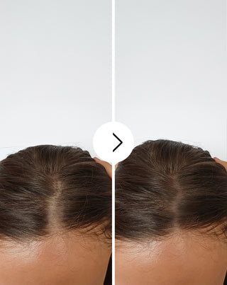 Tobolky proti vypadávání vlasů se zahušťujícími a posilujícími účinky Follixin 60 tobolek_4 - 4