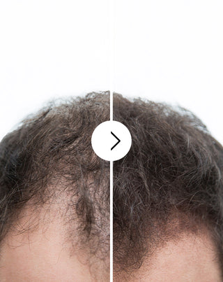 Tobolky proti vypadávání vlasů se zahušťujícími a posilujícími účinky Follixin 60 tobolek_2 - 2