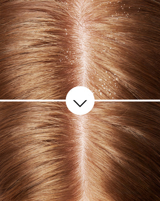 Šampon proti lupům s pirocton olaminem s hydratačním účinkem Nutridome - 5