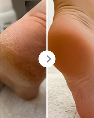 Zvláčňující krém na nohy s močovinou a bambuckým máslem Nutridome - 4