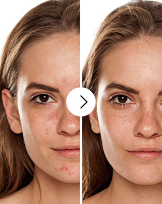 Tablety na akné, pupínky a nedostatky se zinkem, vitamíny C, E a B2 Derminax_2 - 2