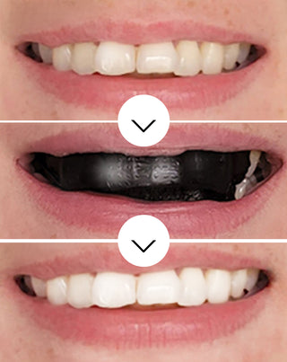 Bělící proužky The White(ning) Stripes Smilebite sada 28 ks - 3