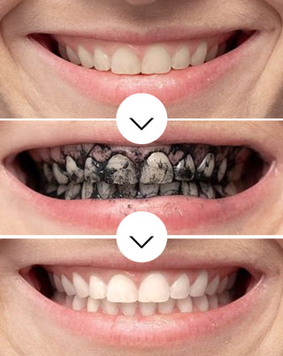 Prášek na bělení zubů Smilebite s kokosovým uhlím - 3